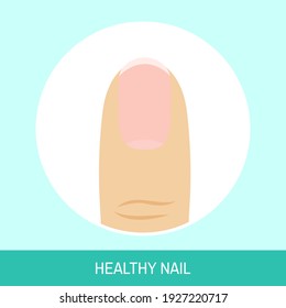 Vector illustration "Healthy nail". Circle icon of fingernail without disorders. Colorful image for medical articles, posters and banners.