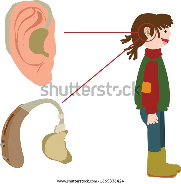 補聴器 耳の不自由な人 聴覚器 子どもの耳の解剖学のベクターイラスト のベクター画像素材 ロイヤリティフリー