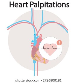 Ilustração vetorial de palpitações cardíacas mostrando ritmo acelerado, batimento cardíaco flutuante, desconforto torácico, tontura, ansiedade e condições relacionadas como arritmia, taquicardia e dor de fibrilação atrial