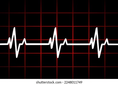 Vector illustration of heart rate and pulse graph