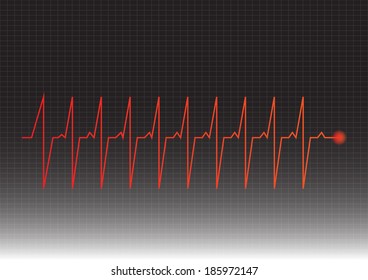 Vector Illustration heart rhythm 