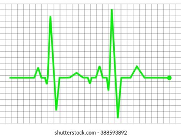Vector Illustration heart rhythm - EKG green line with black grid and transparent background