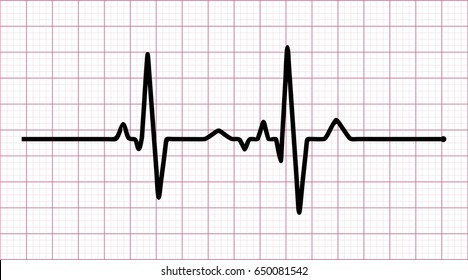 Vector Illustration Of Heart Rhythm Ekg, Ecg On Grid Background .vector