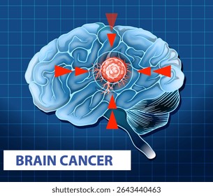 Ilustração vetorial destacando uma célula cancerosa no cérebro humano com setas. Fundo de grade azul melhora o contexto científico