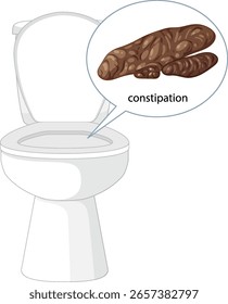 Vektorgrafik, die Verstopfung mit einer Toilette und einer detaillierten Stuhlgrafik hervorhebt. Saubere Linien und stumpfe Farben verbessern die Klarheit