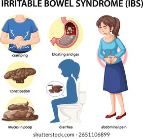 Ilustración vectorial que destaca los síntomas del SII, incluyendo cólicos, distensión abdominal y dolor abdominal. Detallado, colorido e informativo