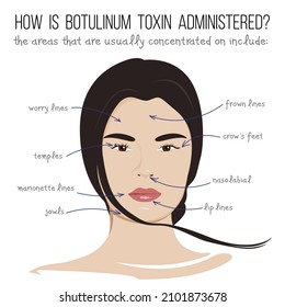 Vector illustration. How is botulinum toxin administered.