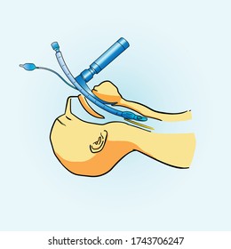 Vector illustration of how ventilator works for corona virus patient, schematic diagram of ventilator going inside the larinx
