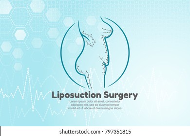 Vector illustration of human body for liposuction surgery. Blue medical background with structure molecule and heart beat