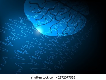 Vector illustration of human brain and abnormal brain waves waves representing focal seizure