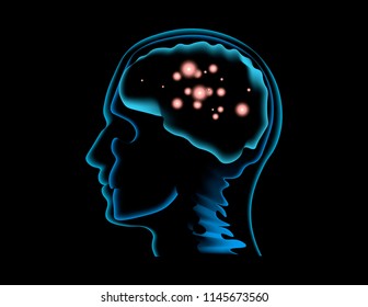 
Vector illustration of a human brain scan during a thought process