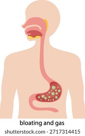 Ilustração vetorial do sistema digestivo humano destacando inchaço e gases. Anatomia simplificada com cores claras e silenciadas e linhas limpas