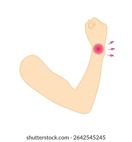 Ilustração vetorial da mão humana mostrando dor no pulso com inflamação vermelha e símbolos de relâmpagos. Adequado para cuidados de saúde, tratamento de lesões, fisioterapia e conteúdo ortopédico.