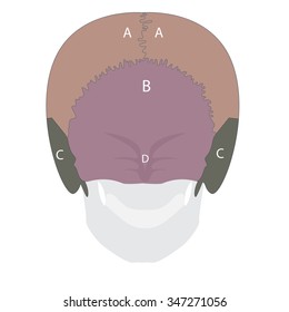 vector illustration of human head bones types. back view.