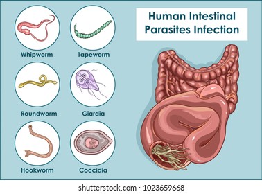 Hogyan lehet felismerni a pinworms et, Hogyan lehet gyógyítani a pinworm férgeket