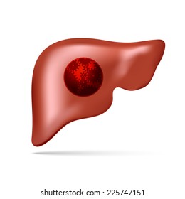 Vector illustration of human liver with gear and cogwheel concept