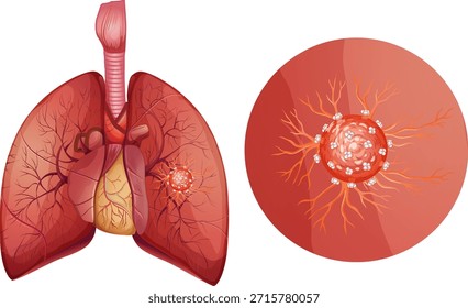 Ilustración vectorial de los pulmones humanos con un enfoque en la estructura celular. La anatomía detallada y los colores vibrantes mejoran el valor educativo
