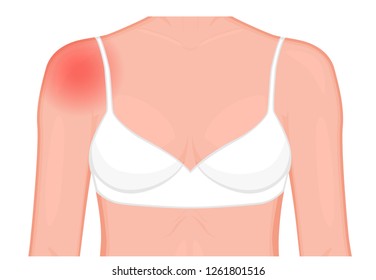 Vector illustration of a human shoulder joint with a pain or injury. Front view. For advertising, medical publications. EPS 10