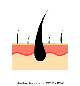 Vector illustration of human skin. The epidermis is layered with hair follicles. Healthy skin anatomy medical vector illustration. Dermis and skin epidermis, hypodermis.