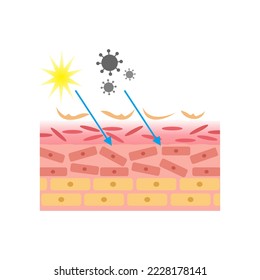 vector illustration of human skin structure anatomy. damaged and exposed by bacteria, dirt and UV rays. epidermis and desmis. illustration for science and medical health.
