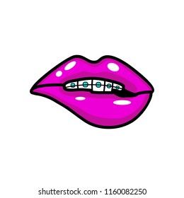 Vector illustration icon of opened mouth with pink lipstick, white teeth and braces