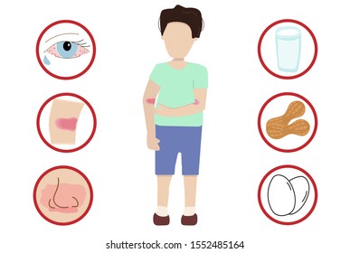 Vector illustration. infographic design of a child food allergy. Hand Draw trendy flat style. Allergy causes and symptoms. Simple. Isolated on white