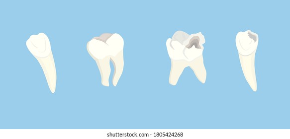 vector illustration isolated on blue background healthy teeth and teeth with caries