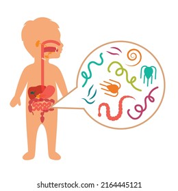 Vector Illustration of a kid Intestinal Parasites, worm disease