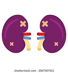 Vector illustration of a kidney with a diseased condition, suitable for advertising health and education products