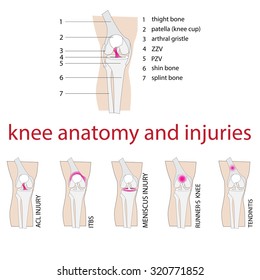 Vector Illustration Of Knee Anatomy And Injuries