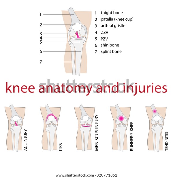 膝の解剖学とけがのベクターイラスト のベクター画像素材 ロイヤリティフリー 320771852