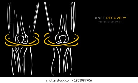 Ilustración vectorial de la recuperación de la rodilla. Afiche o pancarta médico creativo.