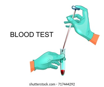 vector illustration of laboratory analysis of blood