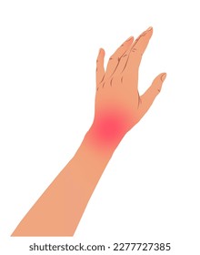 Vektorgrafik der linken Hand mit Karpaltunnelsyndrom