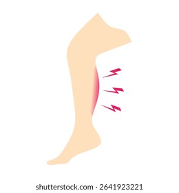 Vector illustration of leg calf pain showing muscle cramp or injury with lightning pain symbols. Medical, therapy, sports injury, and healthcare concept.