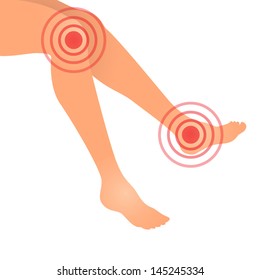 Vector illustration of leg joints pain, medical supplement or medicine concept