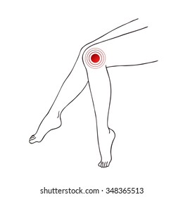 Vector illustration of leg with knee pain. Line vector illustration