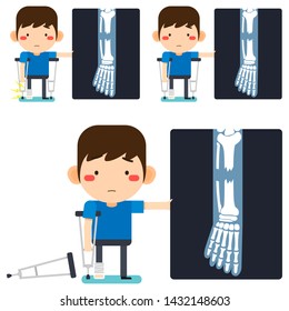 Vector illustration, Leg x-ray Tiny cute cartoon patient man character right leg broken in gypsum bandage or plastered leg standing with axillary crutch on white background