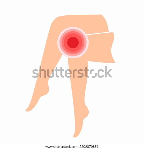 Vector Illustration Legs Pain Knee Joint Stock Vector (Royalty Free