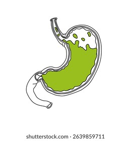 Vector illustration line drawing, stomach disease Gastroesophageal Reflux Disease. Comparison of normal stomach with GERD stomach. Illustration for medical, poster symbol, logo, or study science