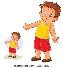 Vector illustration of a little boy with a rash on his hands and legs, chickenpox, smallpox, allergies. Print