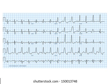 vector illustration looks like real cardio diagram