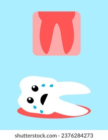 Vector illustration of a lost tooth in cartoon style