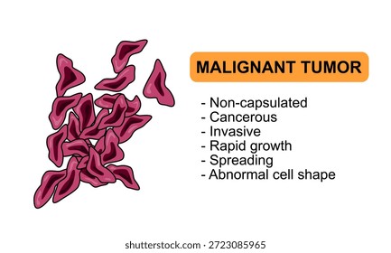 Ilustração vetorial de um tumor maligno. Características de tumores malignos, células cancerosas, invasivas. Ilustração para diagrama médico, elemento de design, cartaz ou treinamento.