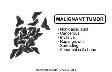 Ilustração vetorial de um tumor maligno. Características de tumores malignos, células cancerosas, invasivas. Ilustração para diagrama médico, elemento de design, cartaz ou treinamento.	