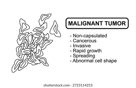 Ilustração vetorial de um tumor maligno. Características de tumores malignos, células cancerosas, invasivas. Ilustração para diagrama médico, elemento de design, cartaz ou treinamento.	