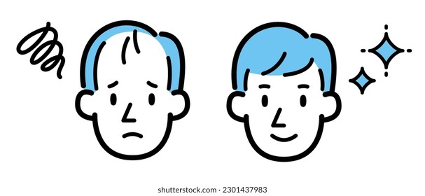 Ilustración vectorial de un hombre que sufre de adelgazamiento de cabello y de un hombre con pelo esponjoso y una sonrisa