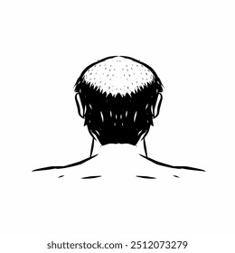 ilustração vetorial da cabeça de um homem experimentando a perda de cabelo no topo e na frente da cabeça, vista por trás