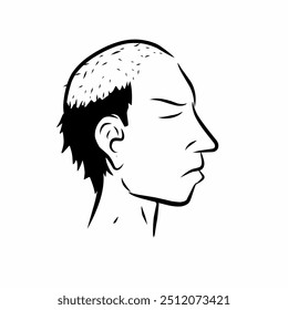 ilustração vetorial da cabeça de um homem experimentando a perda de cabelo no topo e na frente de sua cabeça, visto de lado