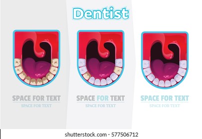 Vector illustration. Medical Poster. Dentist. Healthy Clean Teeth. Providing Dental Care Process.Teeth with Caries. Dental Treatment.ENT.Treatment Process.Screaming mouth.Doctor.Smile Happy logo